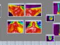Anatomical Anomalies Sample 2